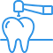 dental inlays treatments